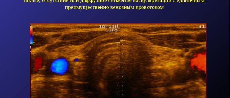 Что такое локусы васкуляризации