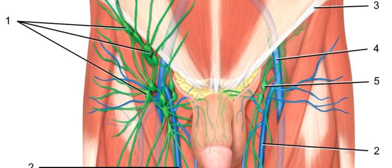 В паху твёрдая вена