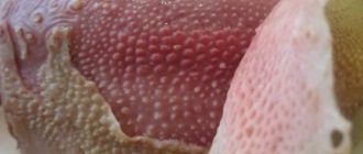 Налёт на половых органах