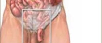 Внезапно пропала смегма и возникли тянущие ощущения в паховой области