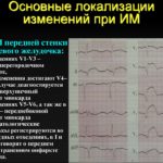 Можно ли рожать с кардиостимулятором?