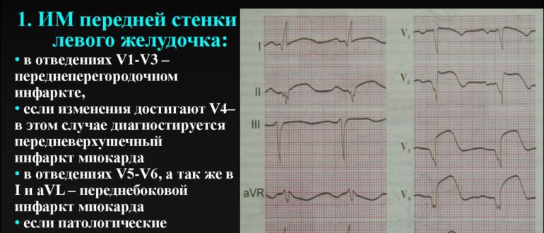 ЭКГ - изменение миокарда, снижение кровоснабжения в передне-септальной области. Опасно?