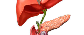 Дискинезия желчного пузыря и хронический холецистит