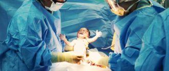 Можно ли рожать при шунтировании