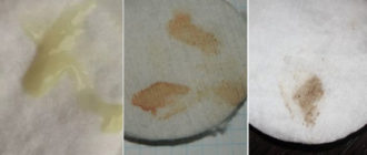 Выделения перед месячными за 4 дня до месячных