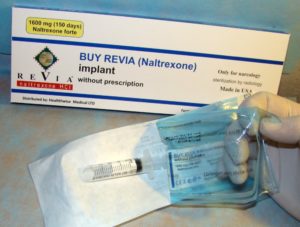 Налтрексон имплант: подшивка наркотиков