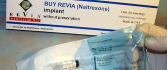 Налтрексон имплант: подшивка наркотиков