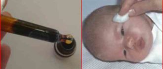 Чем можно заменить Колларгол при дакриоцистите