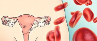 Эндометриоз и длительные кровотечения