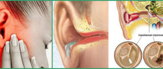 Можно ли после отита, с заложенным ухом использовать наушники?