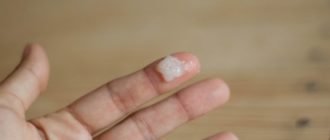 Много белей