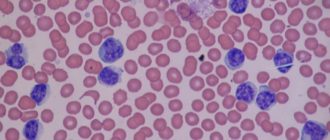 Вироциты у ребенка 2,7