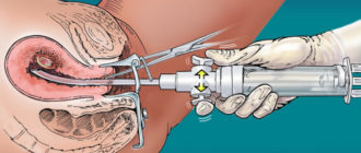 Возможна ли беременность если парень не помыл член и вставил