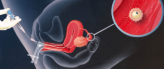 Можно ли забеременеть от спермы в анальном отверстии