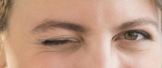 Дергается мышца под левым глазом