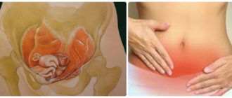 Дискомфорт в области лобка