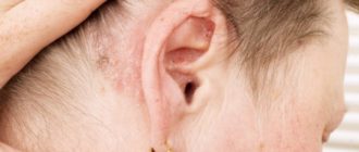 Мокнет ухо