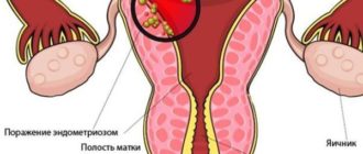 Дискомфорт в матке при оргазме
