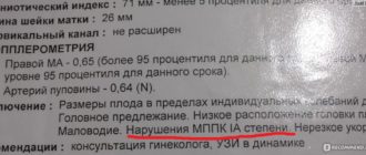 МППК 1б степени