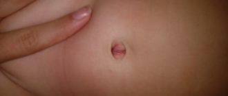 Дырочка в сосочке у ребенка