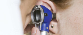 Восстановления слуха после тимпанопластики