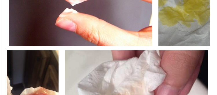 Выделения после Лактожиналя