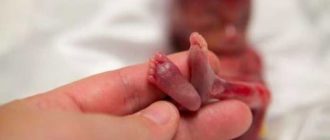 Выкидыш на 19 неделе