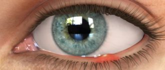 Выделения из глаз