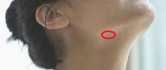 Воспалились лимфоузлы под челюстью, рот неоткрывается. Как безболезненно разжать челюсть