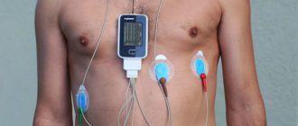 Вопрос по холтеру