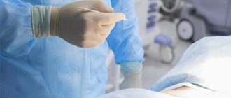 Экспресс биопсия во время операции