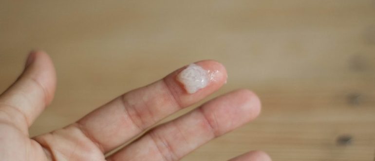 Выделения похожие на частички кожи, жжение, покраснение