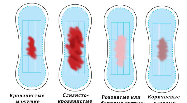Выделения после прижигания током