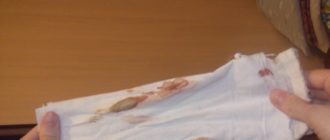 Выделения на 35 неделе беременности