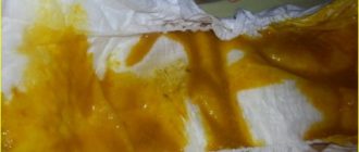 Высокая температура и понос в 4 месяца