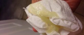 Выделения после опорожнения