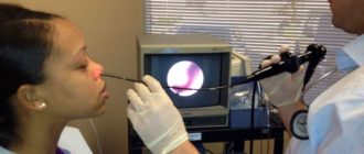 Диагностика катарального гайморита