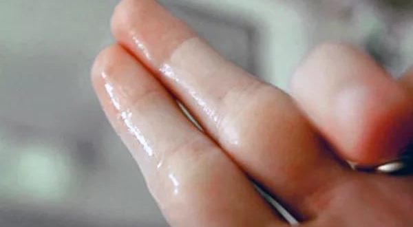 Выделения как вода без запаха