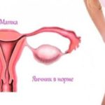 Диарея после приема Клацид СР и постхолецистэктемический синдром