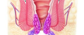 Мокреет задний проход