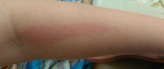 Красная полоска на ножке