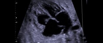 УЗИ сердца плода