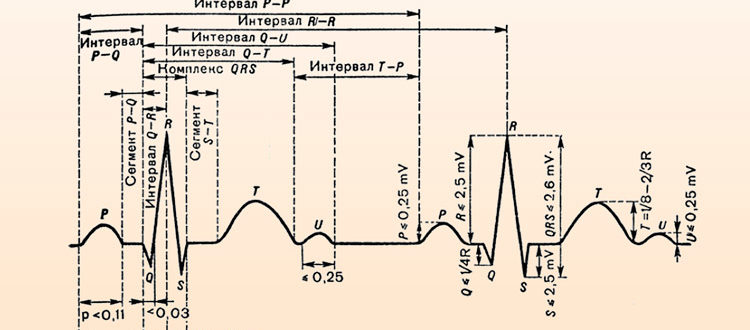 ЭКГ- требуется расшифровка