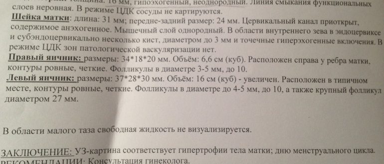 Эндометрий на 6 день цикла 8.2 мм, гиперэхогенный, однородный