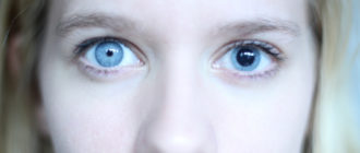 Что делать если зрачки разного размера?