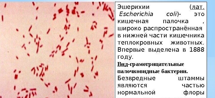 В мазке из глаз обнаружена Escherichia coli. Насколько это серьёзно?