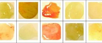 Мокрота глубоко, не откашливается