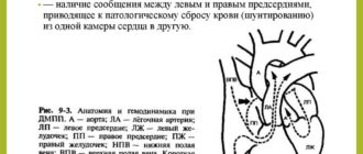 Межпредсердное сообщение