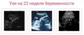 Мутные воды на 22 неделе беременности