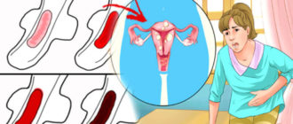 Месячные не такие как всегда